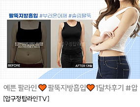 지방흡입은 역시 압구정탑라인의원