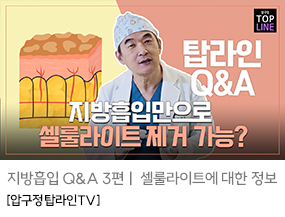 지방흡입은 역시 압구정탑라인의원